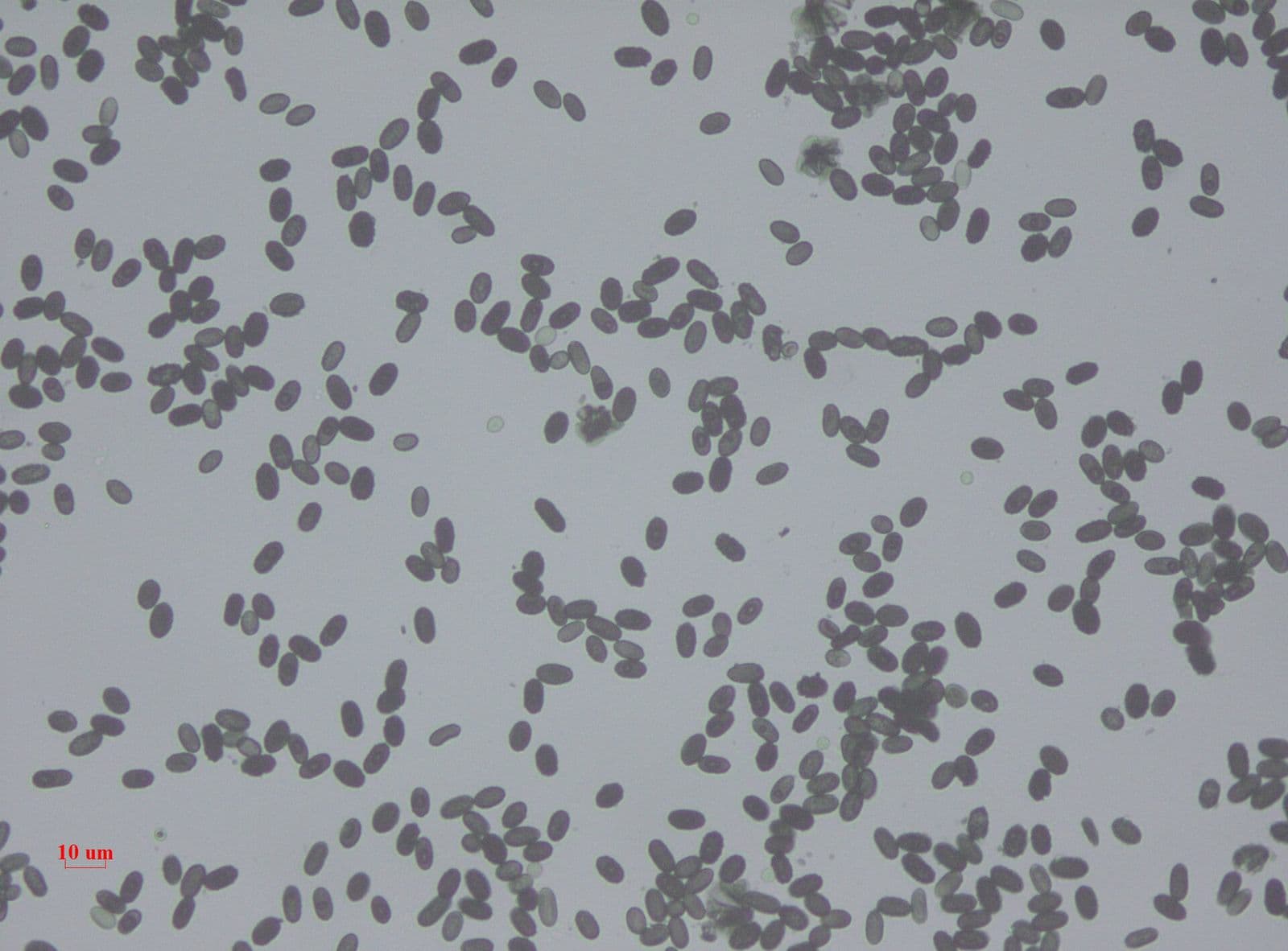 Stachybotrys black mold spores viewed under a lab microscope