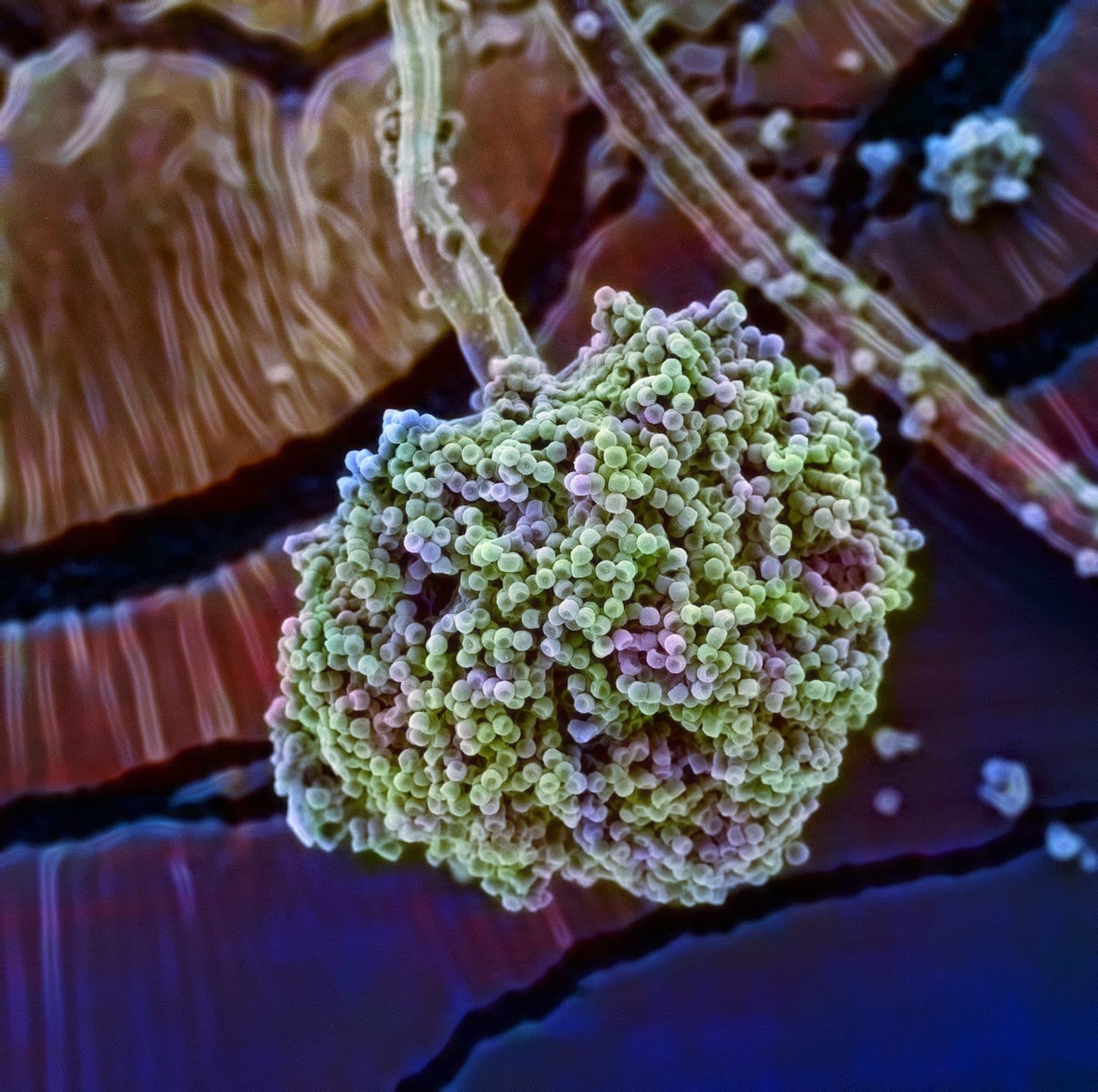 Electron microscope image of a mold spore head releasing spores